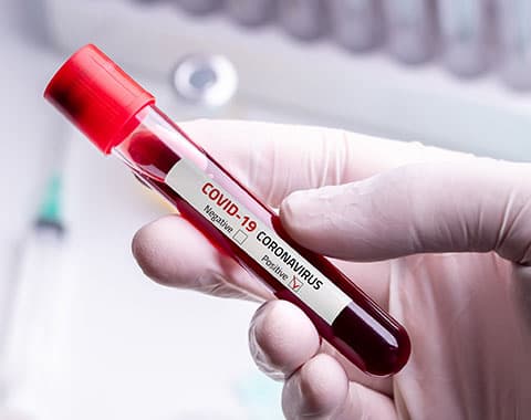 Testou positivo à Covid19?